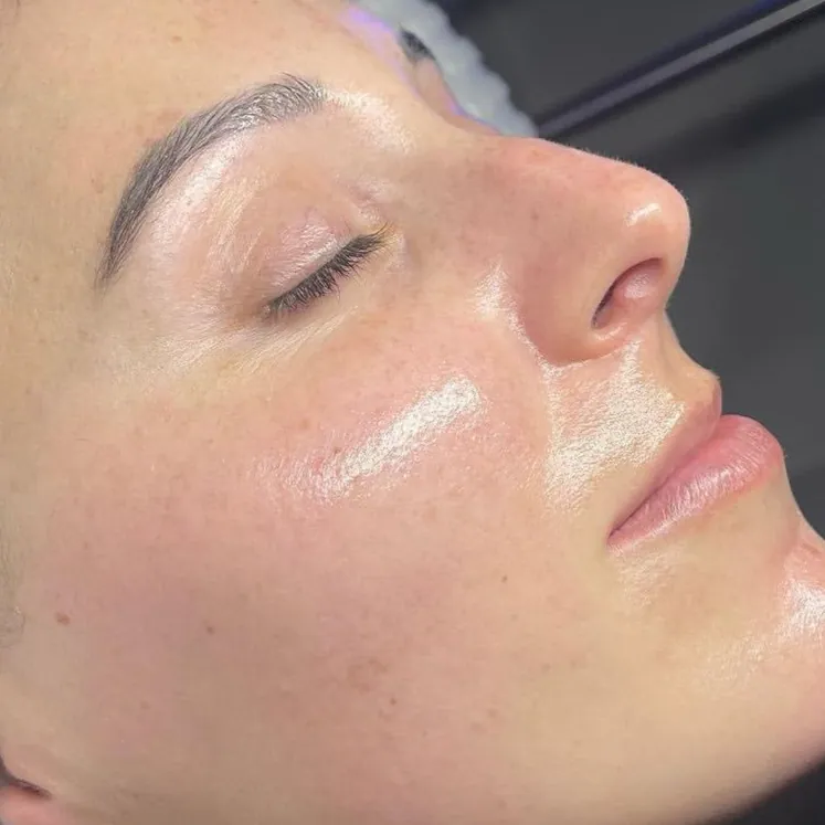 Strahlende Haut nach einem Hydrafacial